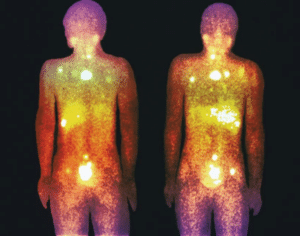 مبانی هسته ای و کاریرد آن در پزشکی